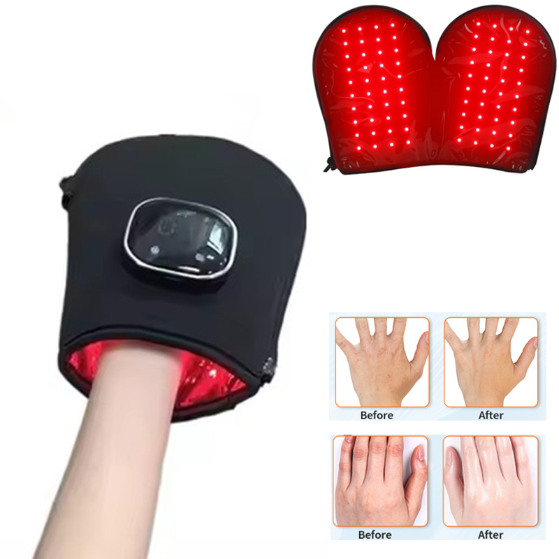 손을 위한 새로운 레드 라이트 테라피 기기, LED 근 - Galvanic Skin Sensor 리뷰 및 가격